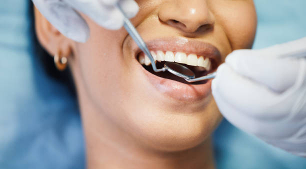 Best Emergency Dental Care for Abscessed Tooth in Winnsboro, TX